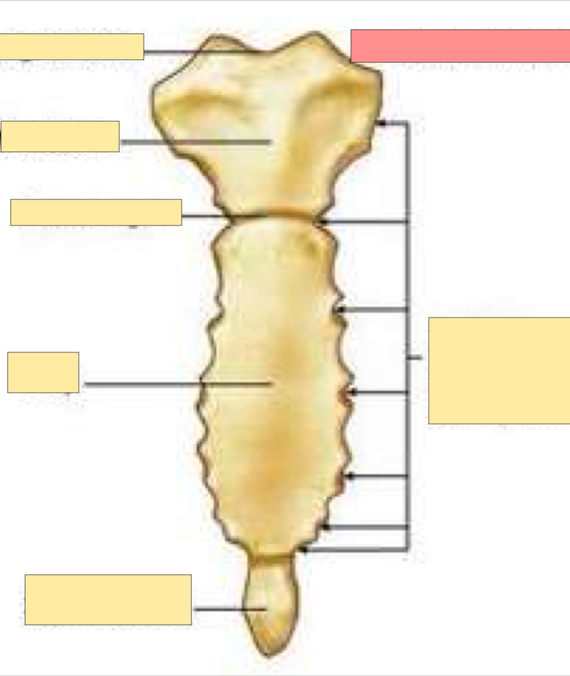 <p>What part of the sternum is this?</p>