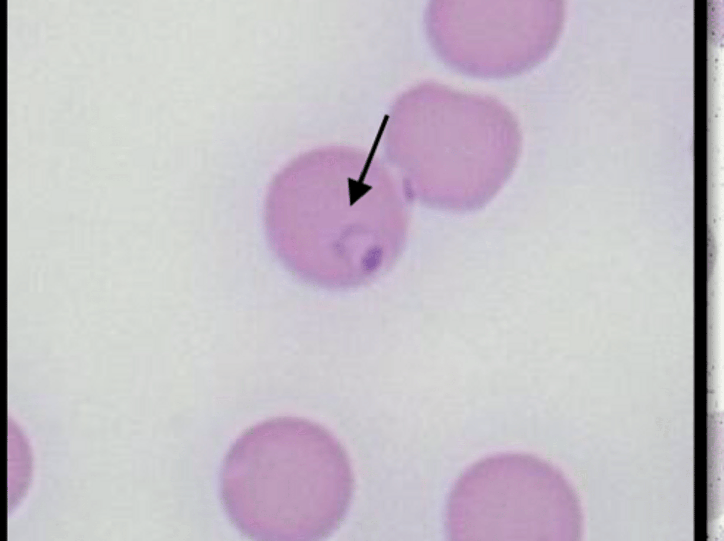 <p>What will Cytauxzoon felis cause? </p>