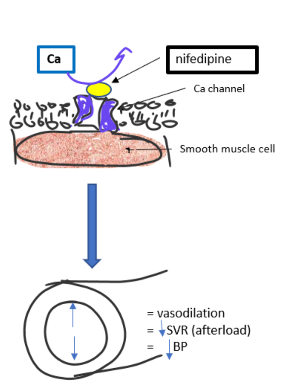 <ul><li><p>block calcium entry into vascular smooth muscle</p></li><li><p>prevent contraction</p></li><li><p>cause vasodilation</p></li><li><p>decrease SVR (afterload)</p></li><li><p>decrease BP</p></li></ul><p><span style="color: green;">acts mainly on arterioles</span></p>