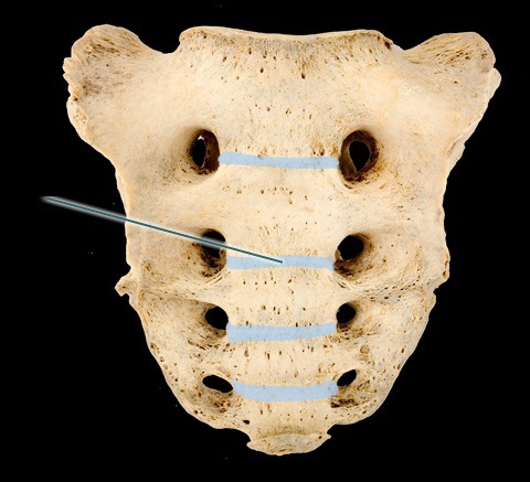 ridges between holes on inside of sacrum