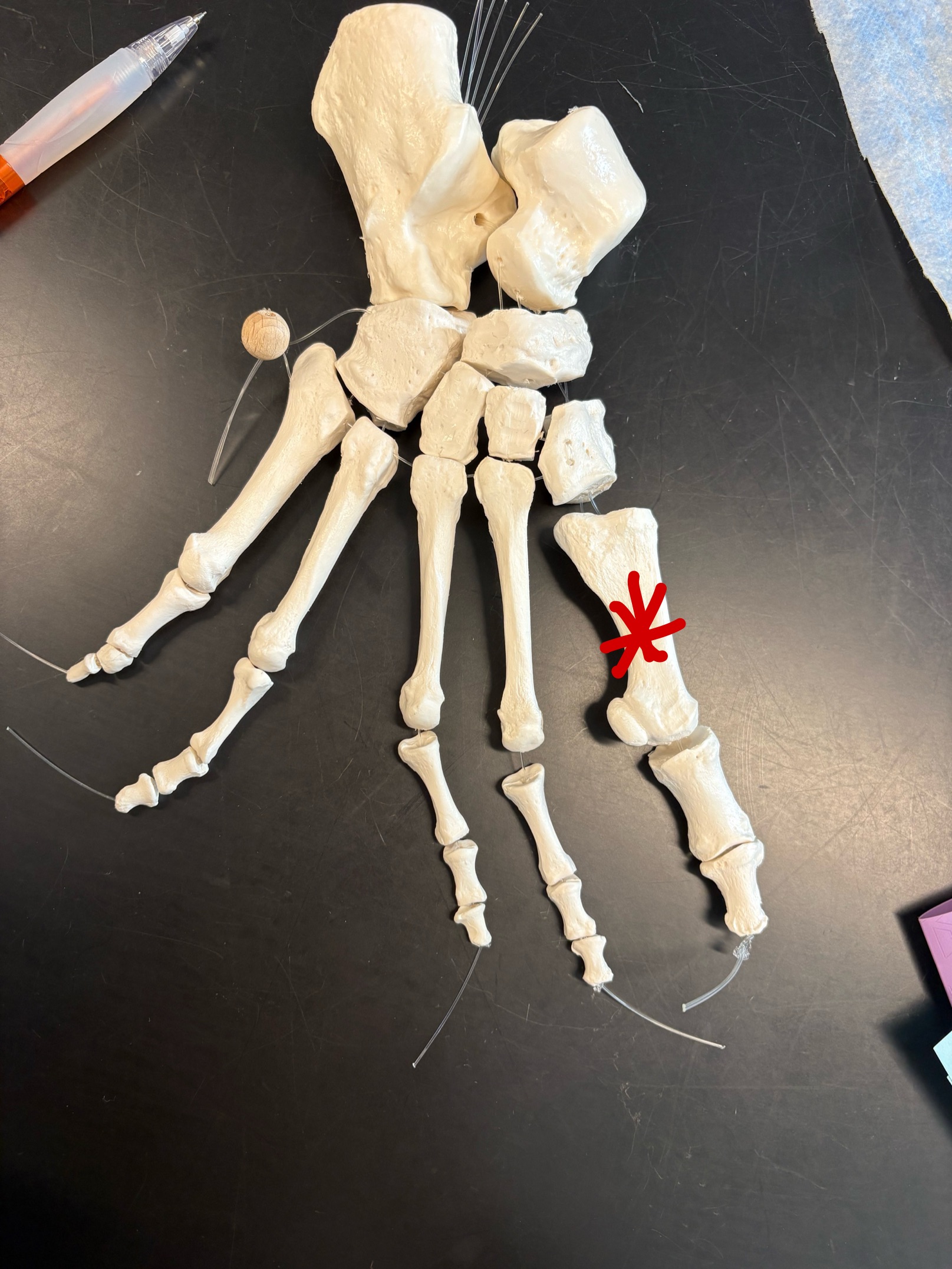 <p>Name this bone</p>