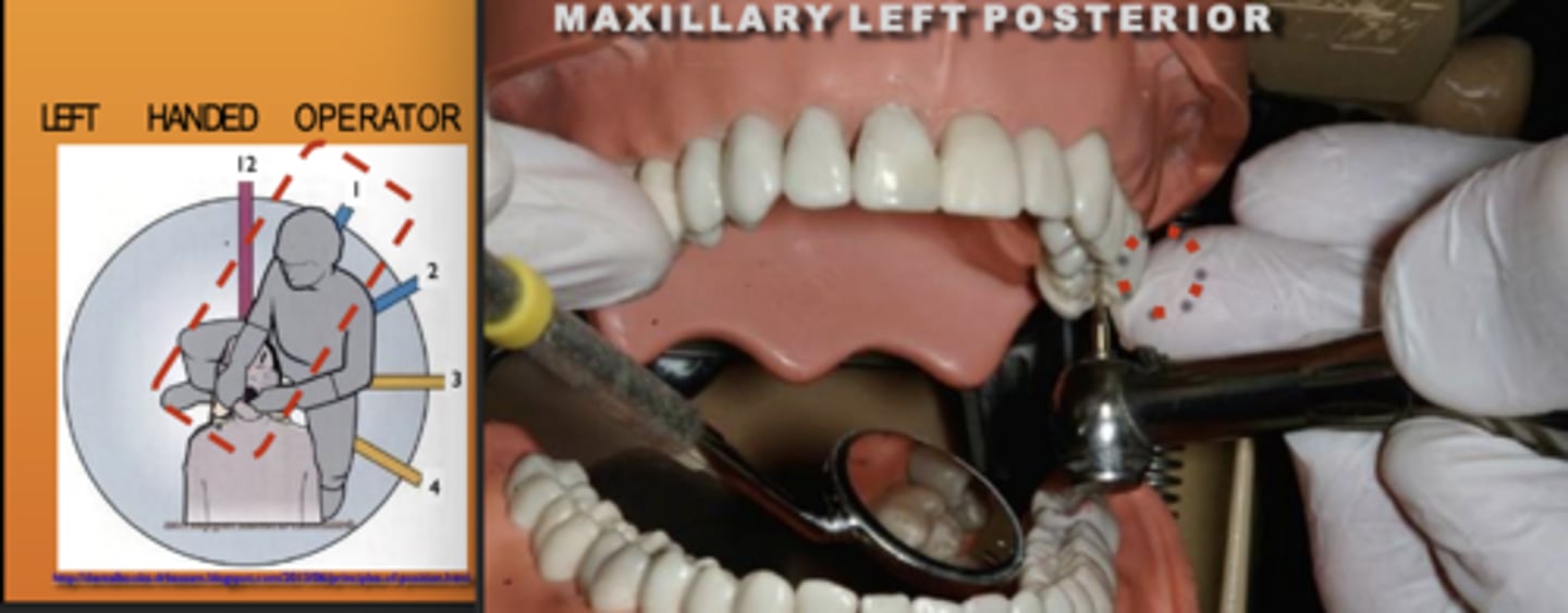 <p>Zone: 1</p><p>Vision: Indirect</p><p>Patient's Head: Center</p><p>Fulcrum: Max Left Poster (B)</p>