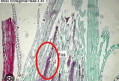 <p>Which part of the Archegonial Head is this?</p>