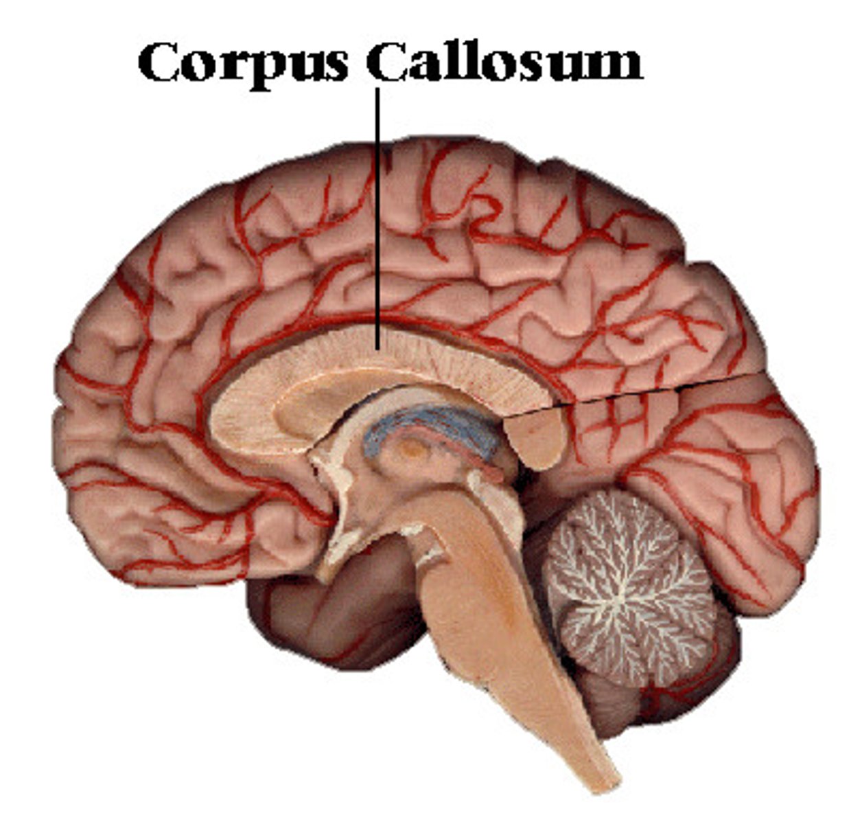 <p>A thick band of axons that connects the two cerebral hemispheres and acts as a communication link between them.</p><p>mnemonic: the corpus callosum allows the left hemisphere to "call" the right and communicate</p>