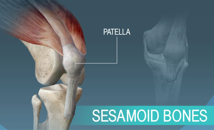 <p>-Small, nodular, enveloped in tendons (free floating)</p><p>-big toe, thumb, knee</p>