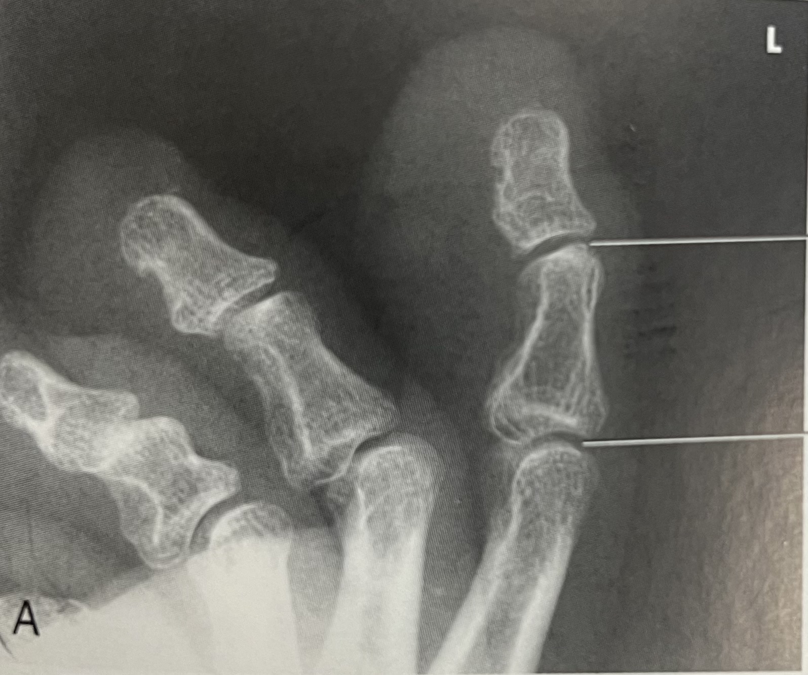 <p>identify the <strong>projection </strong>of the image </p>