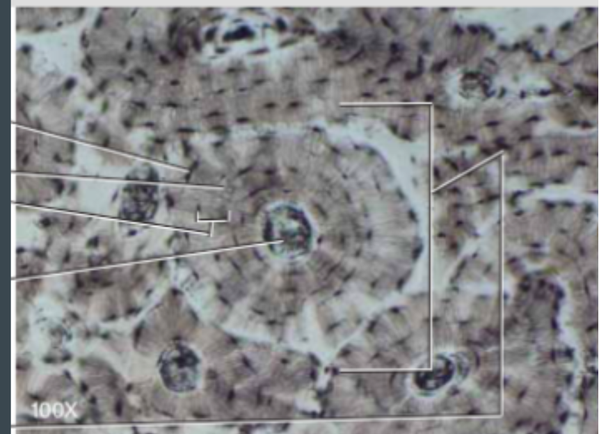 <p>(connective) looks like tree rings</p>