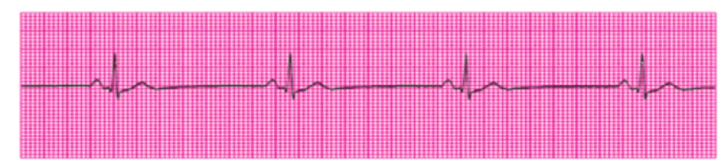 <p>Name this rhythm.</p>