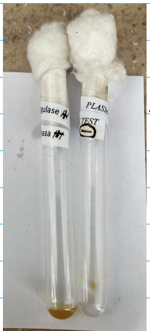 <p><strong>Plasma coagulase test:</strong></p><p>+S. aureus</p><p>-S.epidermidis</p>