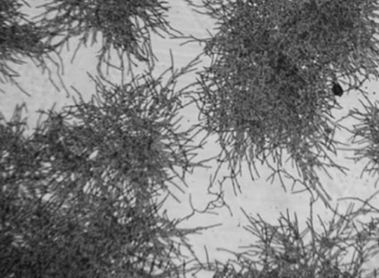 <p>the intertwining mass of hyphae that makes a colony </p>