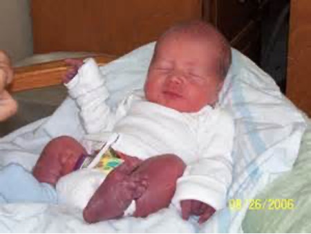 <p><strong>What is a blue cast to the hands and feet when exposed to cold?</strong></p>