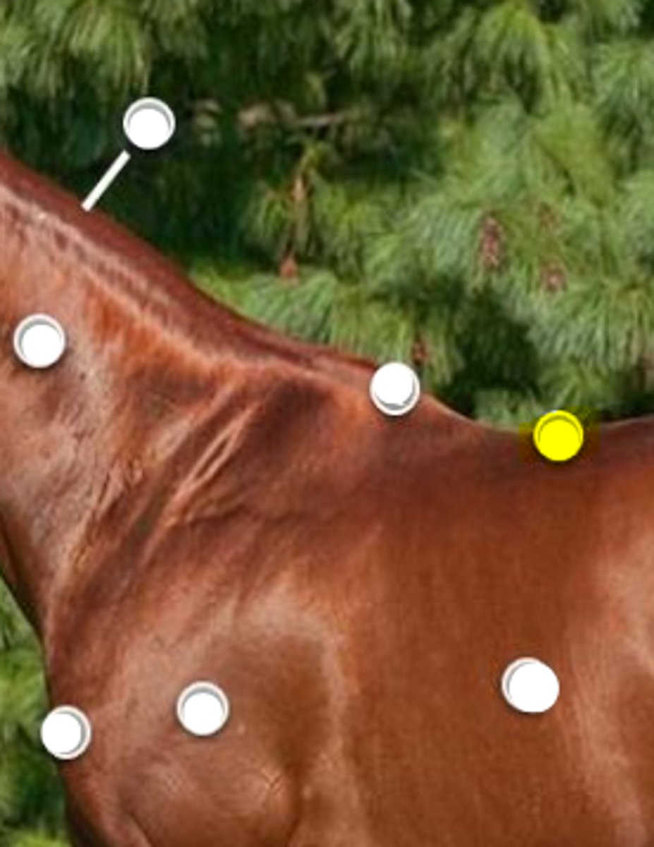 <p>What is body part is indicated on the image</p>