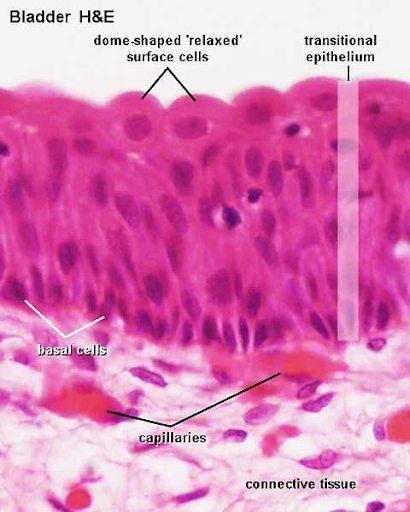 <p>has the characteristic of being able to change shape to accommodate a volume change in the organ it lines</p><p>relaxed state= 4-6 layers</p><p>each surface cell appears umbrella/dome shaped</p><p>when stretched, the top dome-shaped cells become flat (squamous) and the epithelium becomes thinner</p><p>urothelium</p><p>location: kidney renal calyces, bladder, urethra, </p>