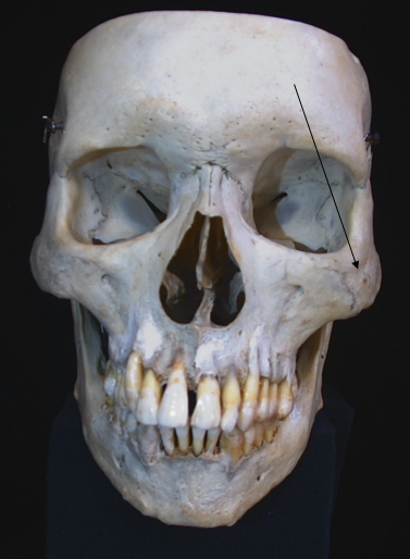 name the bone 