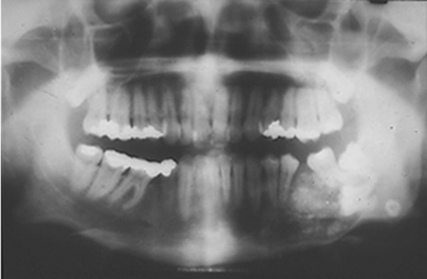 <p>ID the pathology:</p>