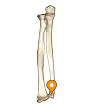 <p>distal end of the ulna</p>