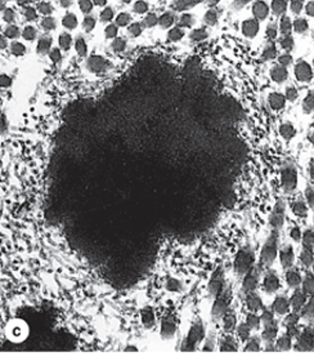 <p>Where does elastin accumulate during elastic fiber formation, and what remains visible on the surface?</p>