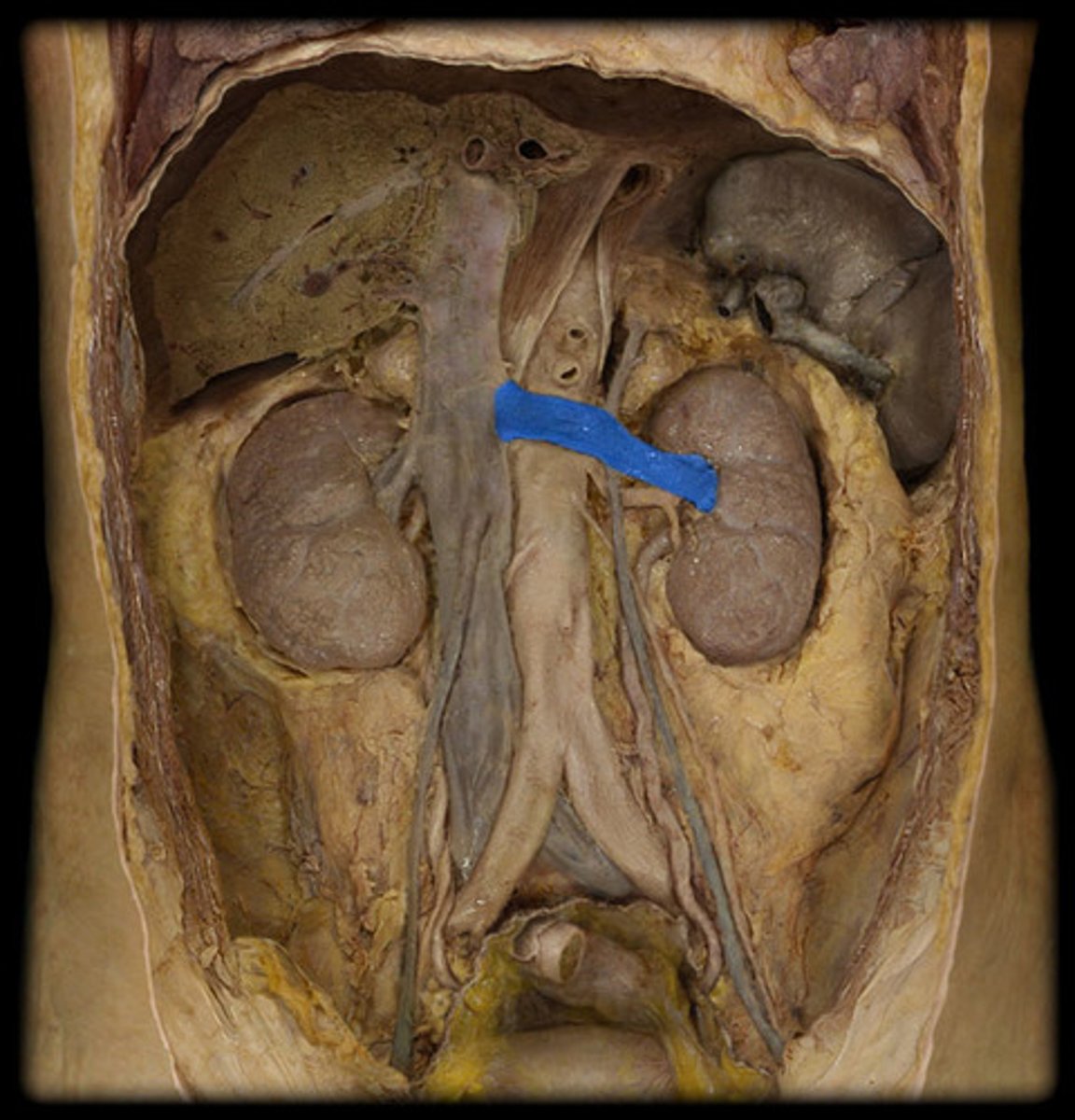 <p>What is this?</p>