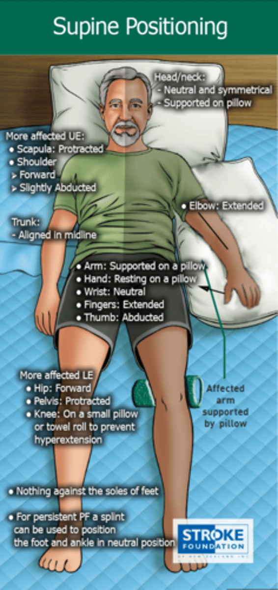 <p>Head/neck: Neutral</p><p>Trunk: midline</p><p>More affected UE:</p><p>-Scapular protraction</p><p>-Shoulder forward and slight ABD</p><p>-Arm supported on pillow</p><p>-Elbow extended</p><p>-Hand on pillow w/ neutral wrist, fingers extended and thumb ABD</p><p>More affected LE:</p><p>-Hip forward</p><p>-Knee on small pillow to prevent hyperextension</p><p>-Nothing against soles of feet</p><p>-Can splint for PF persisting</p>