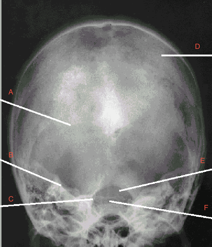 <p> what is B pointing to? </p>