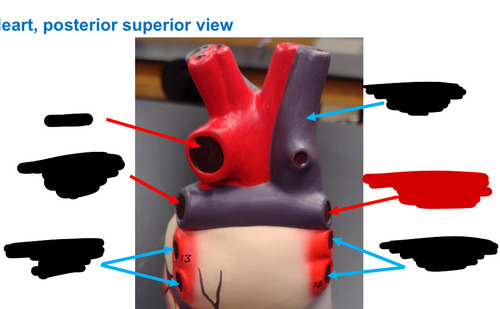 <p>Name this heart vessel</p>