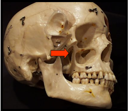 <p><span>A narrow space that separates the lateral pterygoid plate and the maxilla</span></p>