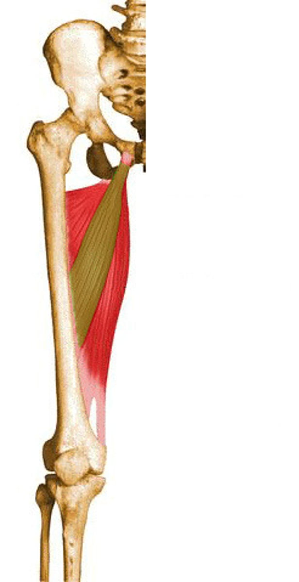 <p>Thigh muscle commonly strained in sports</p>