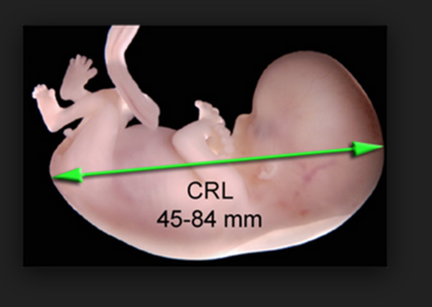 <p>- most accurate measurement of the embryo in the first trimester</p><p>- used to date pregnancy and estimate due date</p><p>used between 7-13 weeks</p><p>- also used to check location, number and viability</p>