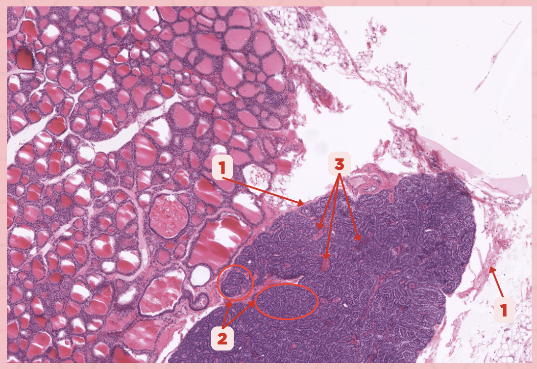 <p>The parathyroid gland is divided into _____, packed with epithelial cells that form cords and clusters.</p>