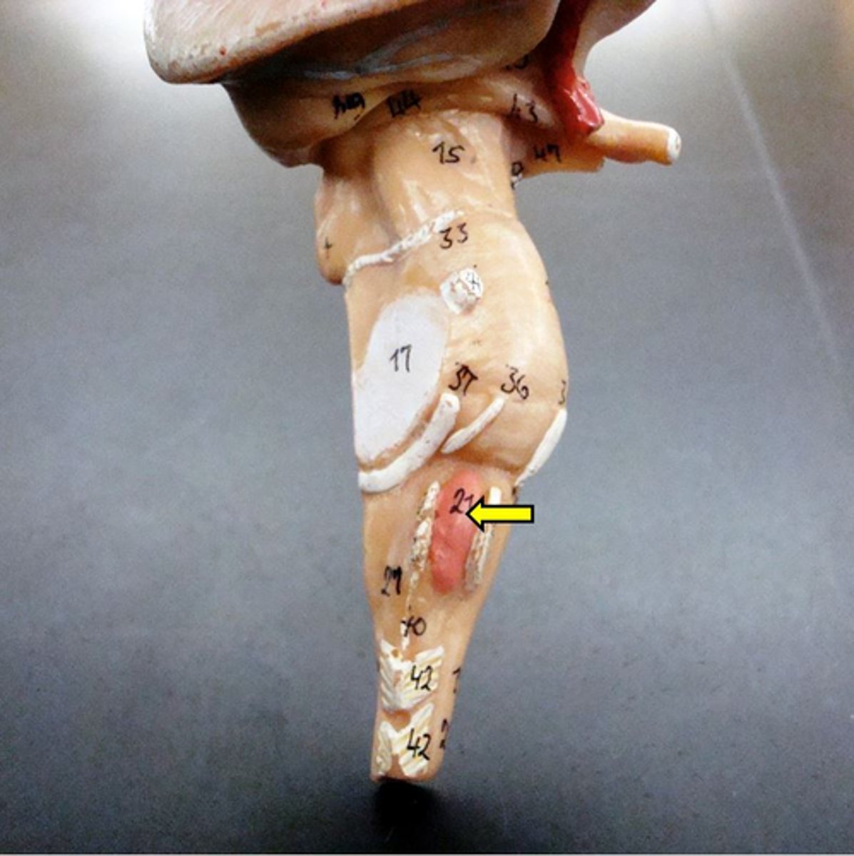 knowt flashcard image