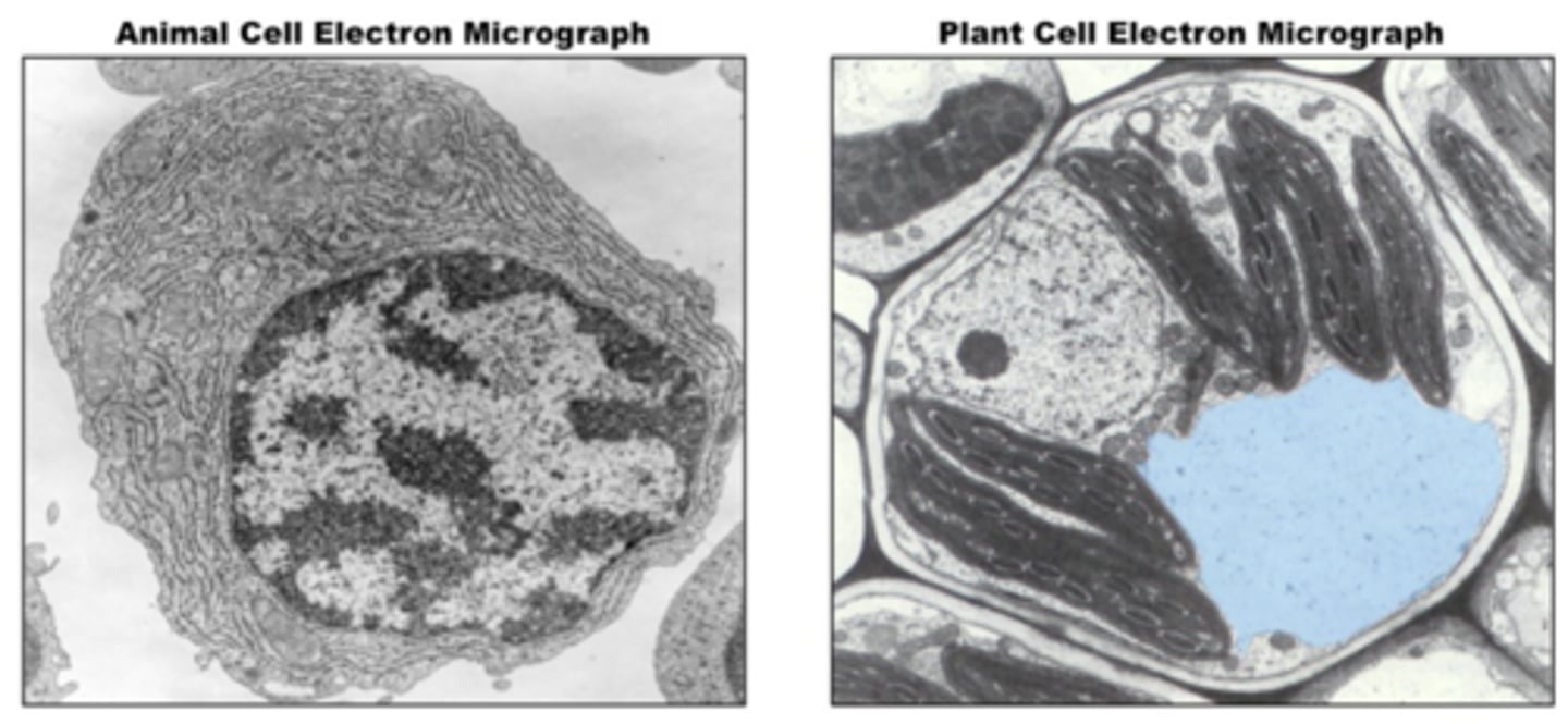 <p>A membranous sac that contains a fluid called sap, which contains dissolved sugars and salts for the cell.</p><p>It allows the cell to become turgid</p><p>It isolates unwanted chemicals from the rest of the cell</p>