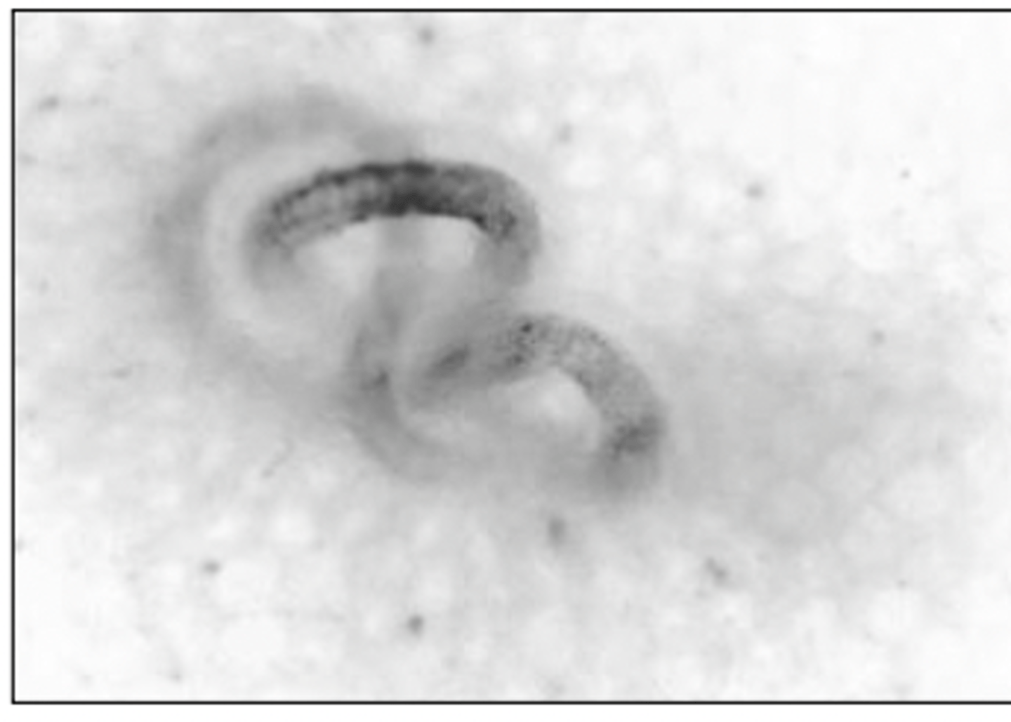 <p>What is this parasite? What characteristic/s did you use to identify it?</p>