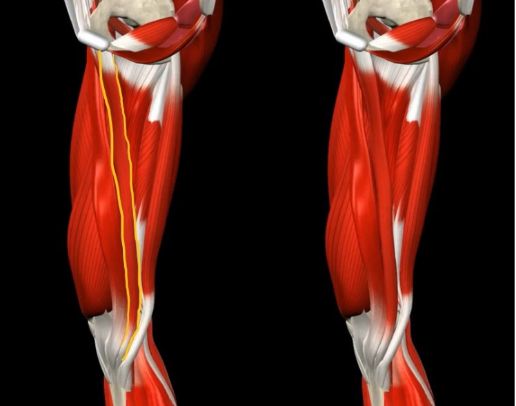 <p>If the muscle outlined in yellow is tight it will likely limit what range of motion?</p>