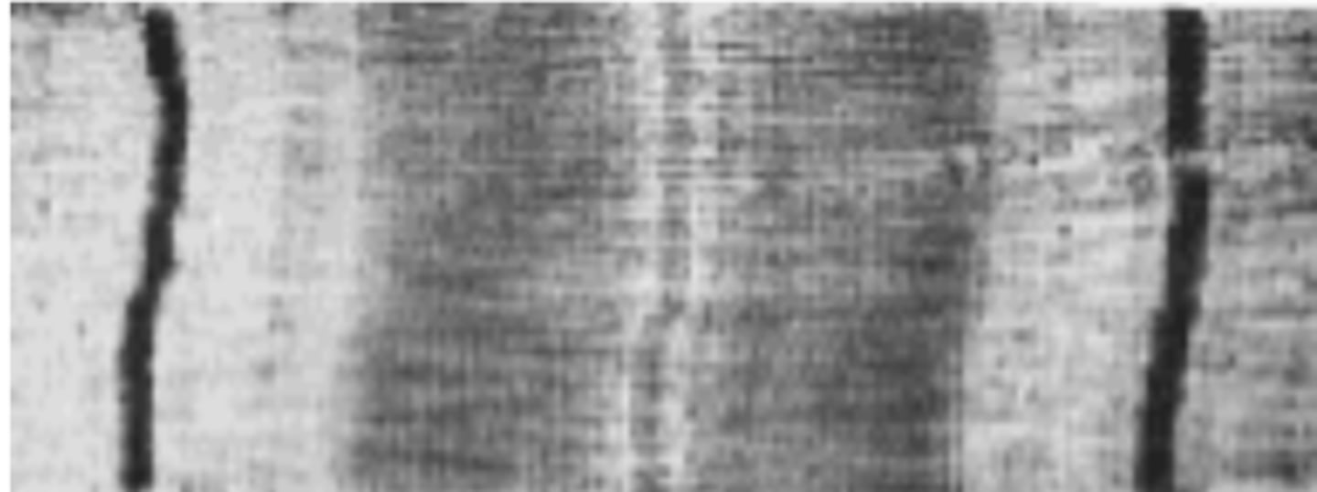 <p>Contraction</p>