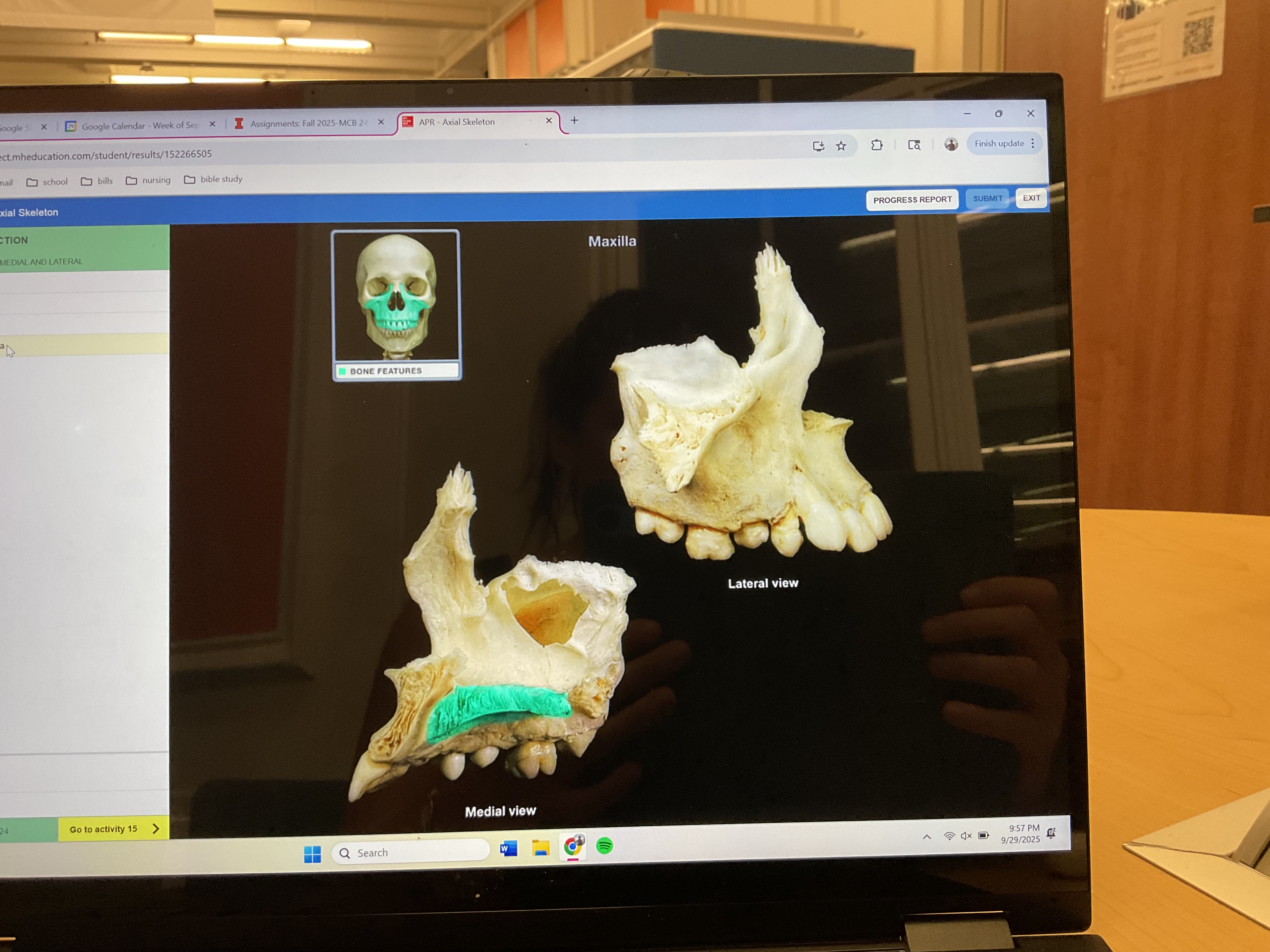 <p>Palatine process of maxilla </p>