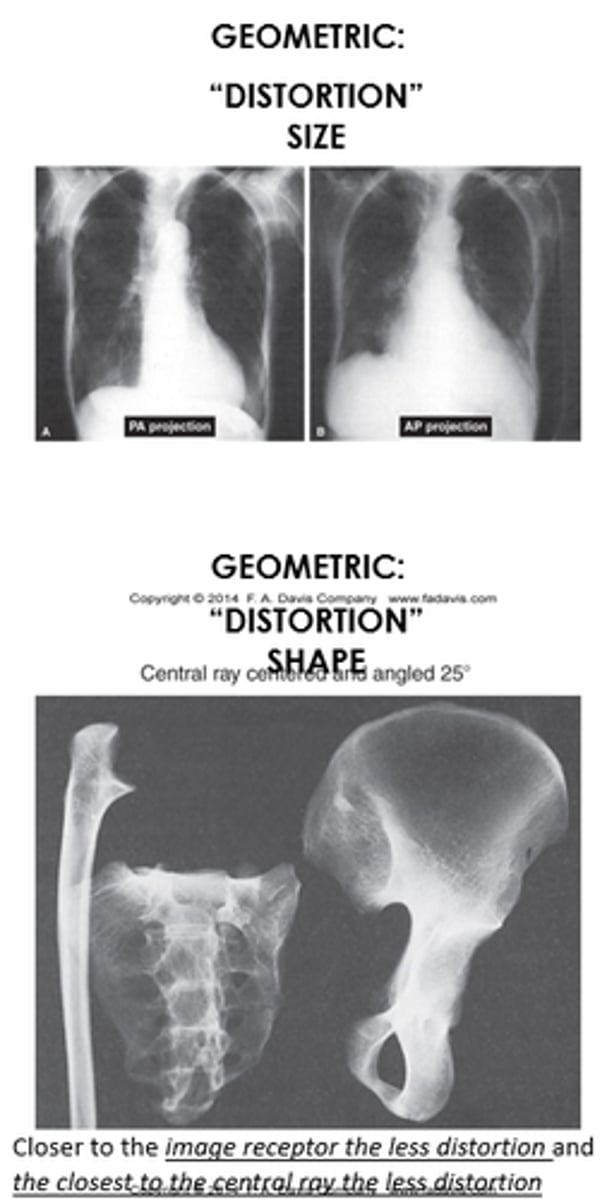 <p>- Difference between actual object and the recorded object. Usually either size or shape distortion</p><p>- Closer to the image receptor the less distortion and the closest to the central ray the less distortion</p>