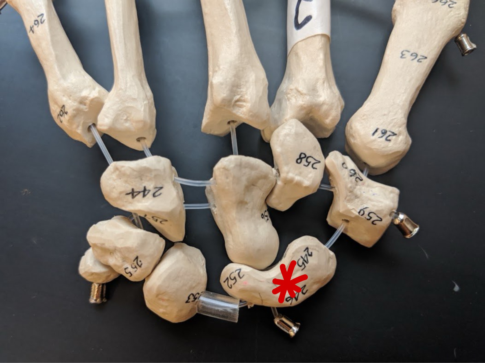 <p>Name this bone</p>