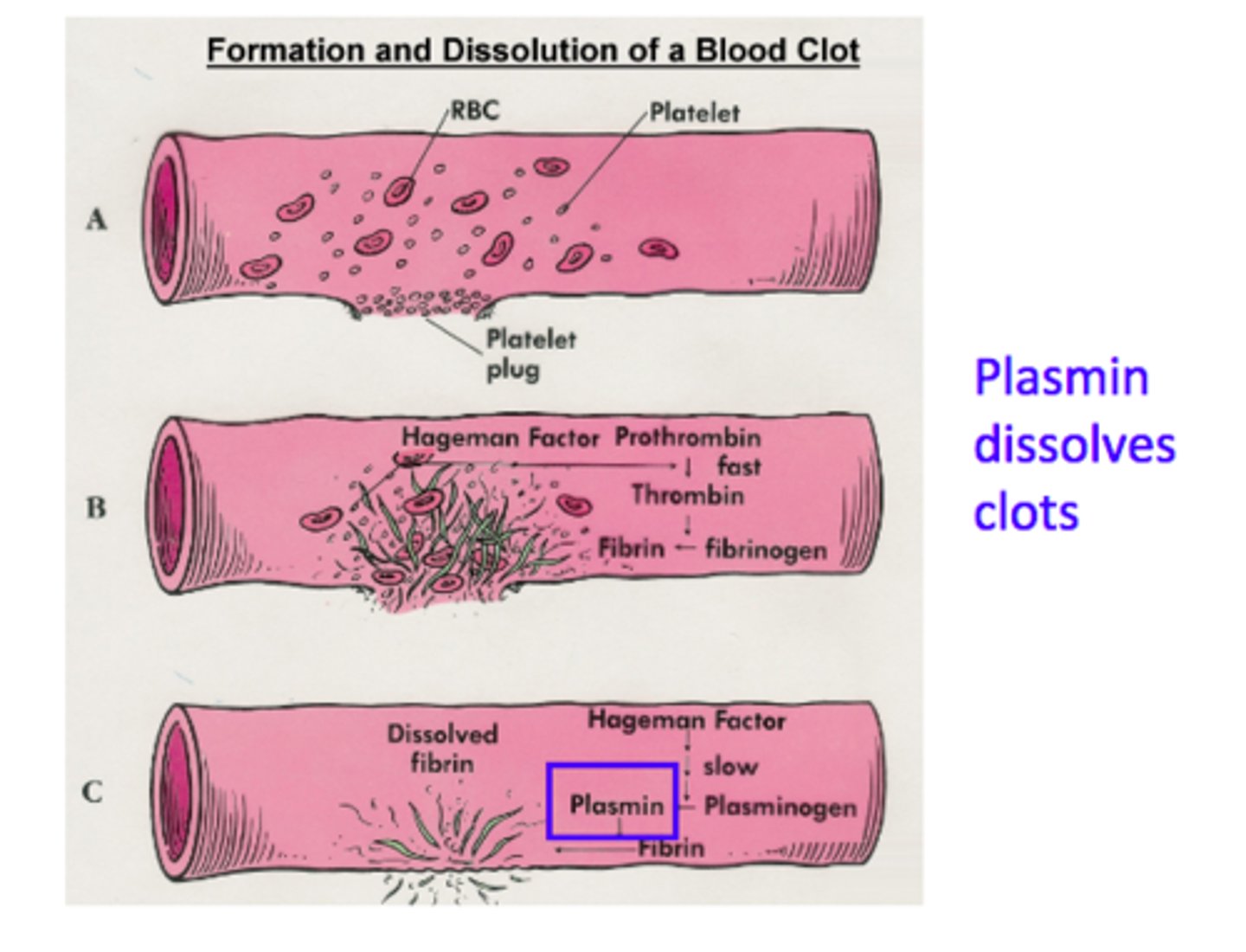 <p>Blood clots are dissolved by the enzyme plasmin</p>