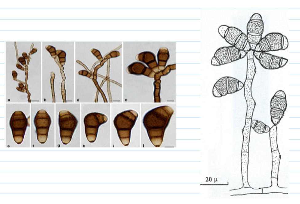 <p>(phaeohyphomycosis) curvularia sp macro + microscopic morphology</p>