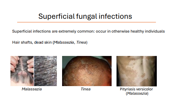 <p>Superficial infections are extremely common: occur in otherwise healthy individuals</p><ol><li><p>Malassezia </p></li><li><p>Pityriasis versicolor (Malassezia)</p></li><li><p>tinea </p></li></ol><p></p>
