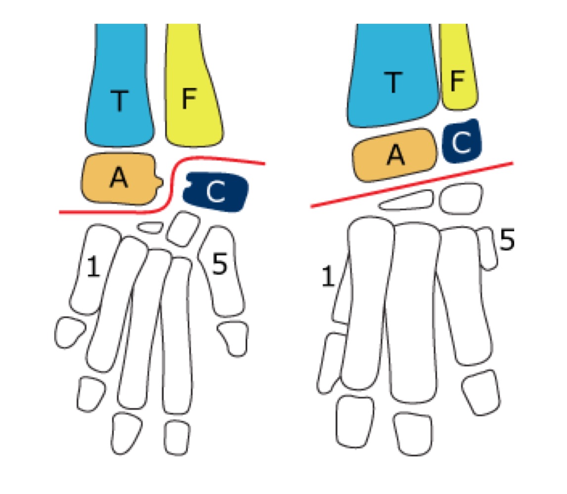 <p>Which joint do Avemetatarsalians/Ornithodirans have?</p>