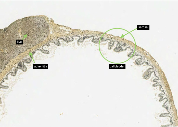 Gallbladder and liver