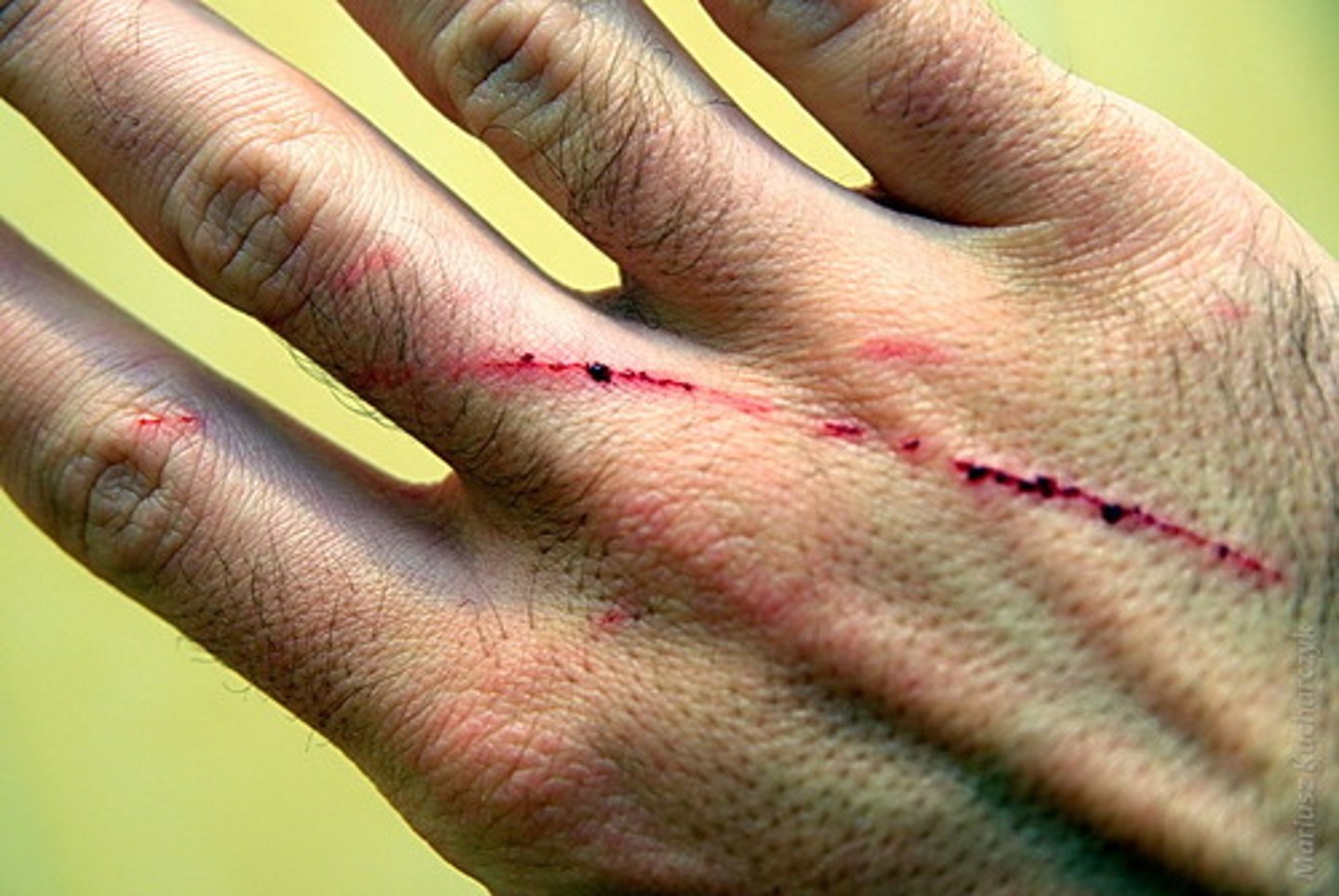 <p>scratch</p>