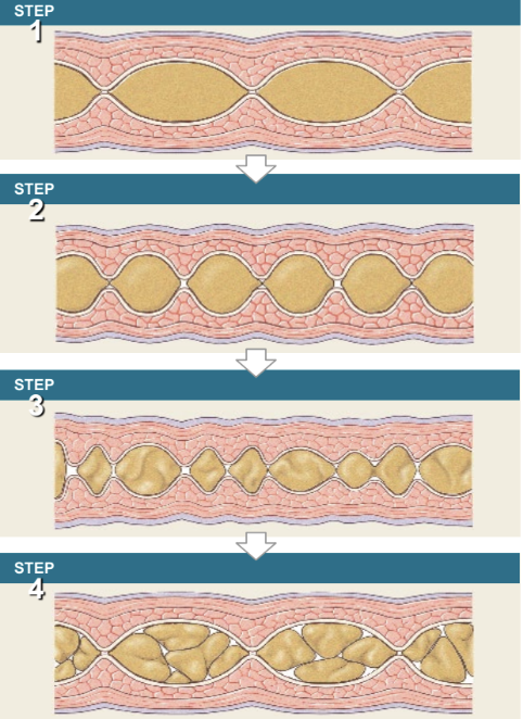 <ul><li><p>occurs primarily in intestine</p></li><li><p>localized contraction in areas where food is present</p></li><li><p>mixes food with enzymes</p><ul><li><p>aid in digestion &amp; absorption</p></li></ul></li></ul><p></p>