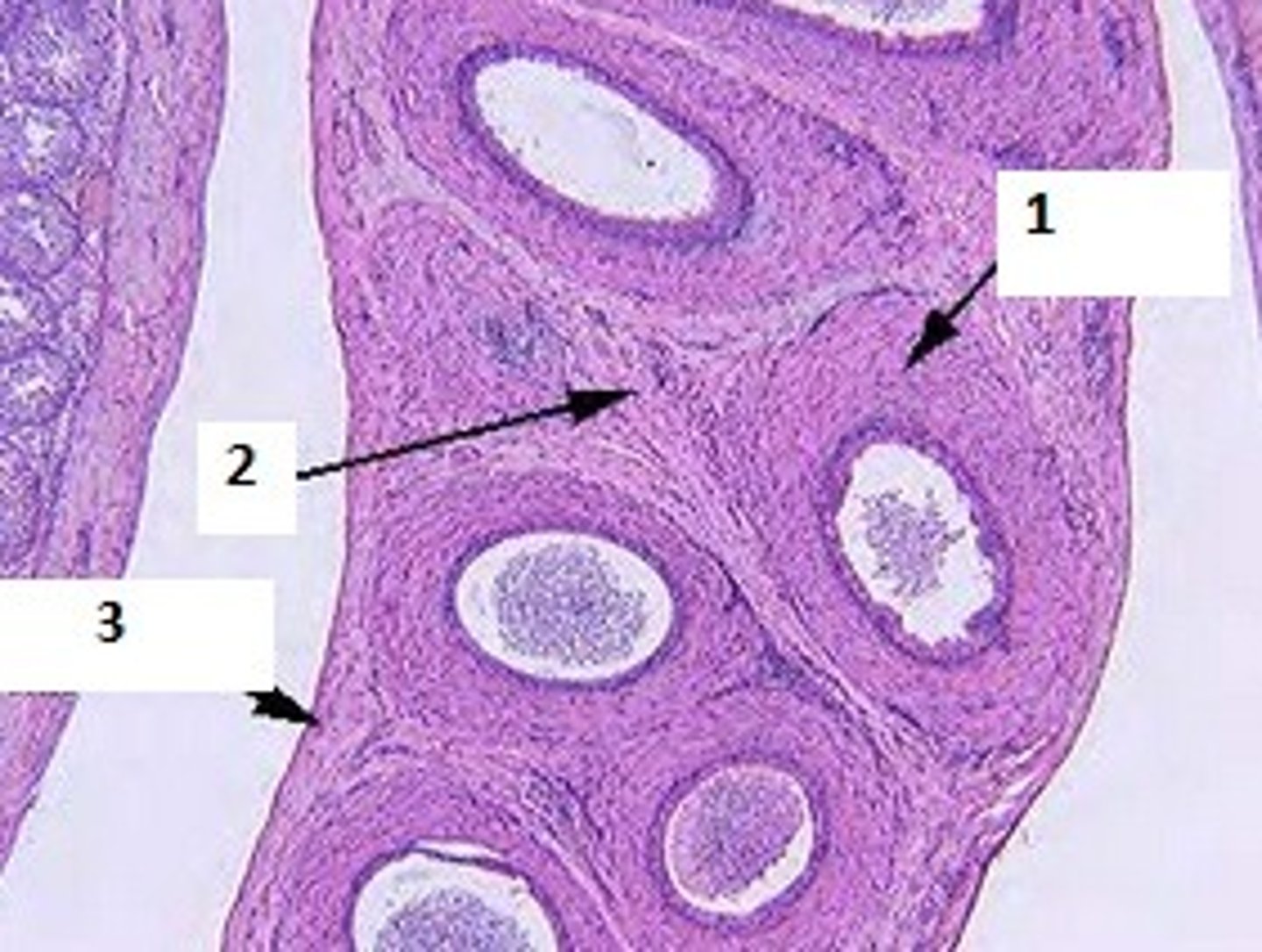 <p>Identify the organ, &amp; #1-3.</p>