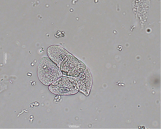 <p>what are transitional epithelial (urothelial) cells? where do they originate from? what are they reported as?</p>