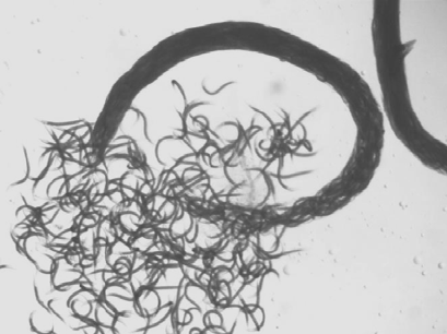 <p>worm bagging</p>