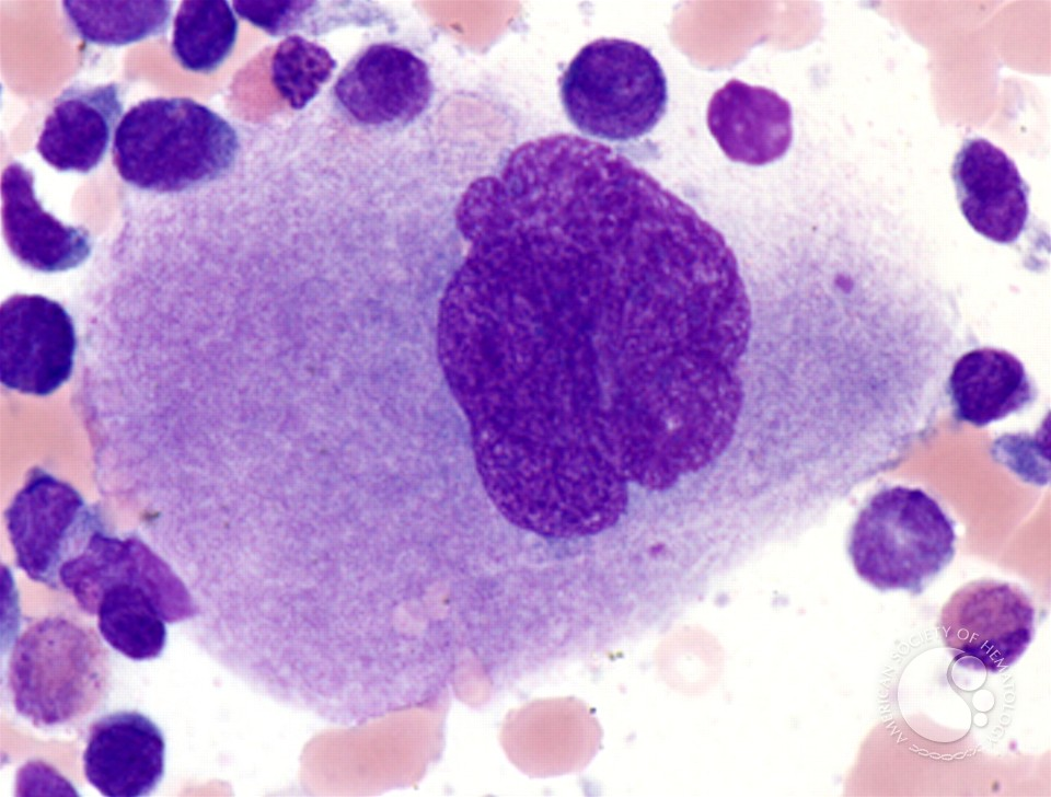 <p>Megakaryocyte</p>