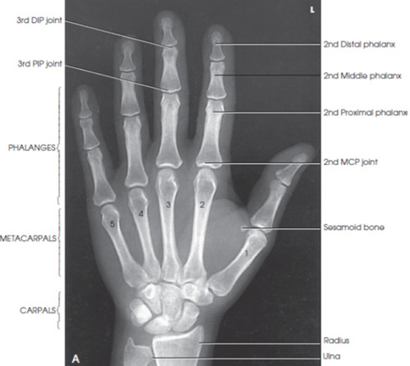 Radiographic procedures essential projections of Hand, wrist, thumb