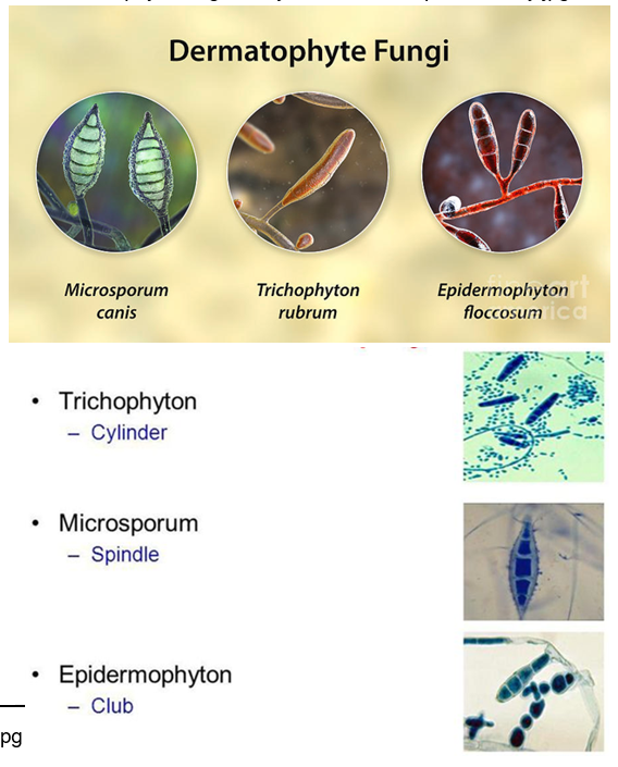 <p>Include species of <strong>Microsporum</strong>, <strong>Epidermophyton</strong>, and <strong>Trichophyton</strong>. </p><p>These filamentous fungi form <strong>branching septate hyphae</strong> and conidia</p>